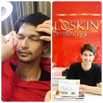 Harga Perawatan di Gloskin Balikpapan