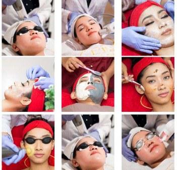 Jenis Perawatan di Klinik Kecantikan Ella Skincare