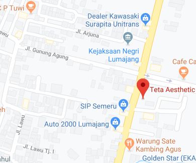 Daftar Lokasi Perawatan Teta