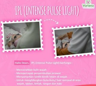 Jenis Perawatan di Vanela Beauty Care