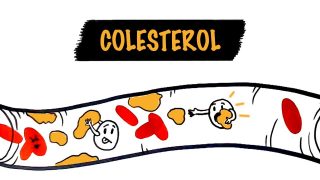 Biaya Cek Kolesterol