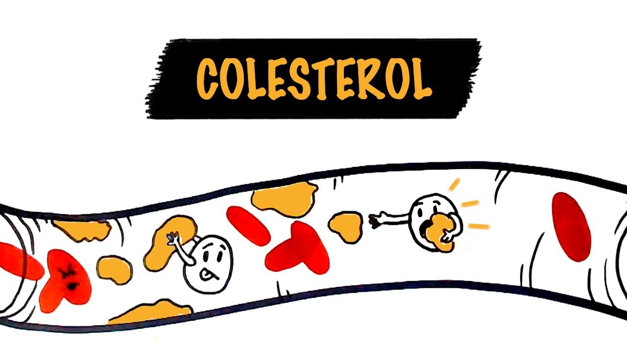 Biaya Cek Kolesterol