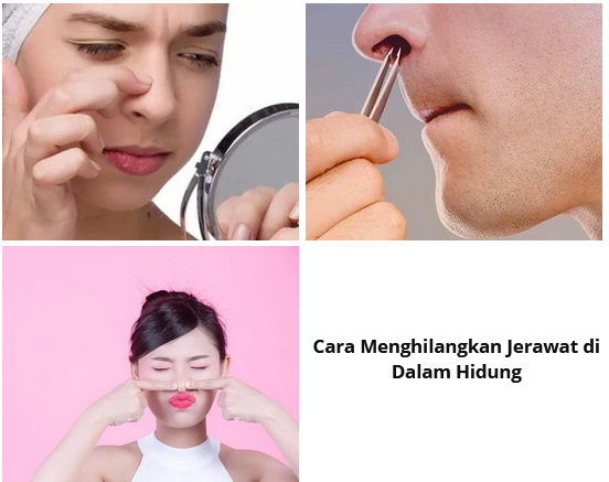 Cara Menghilangkan Jerawat di Dalam Hidung